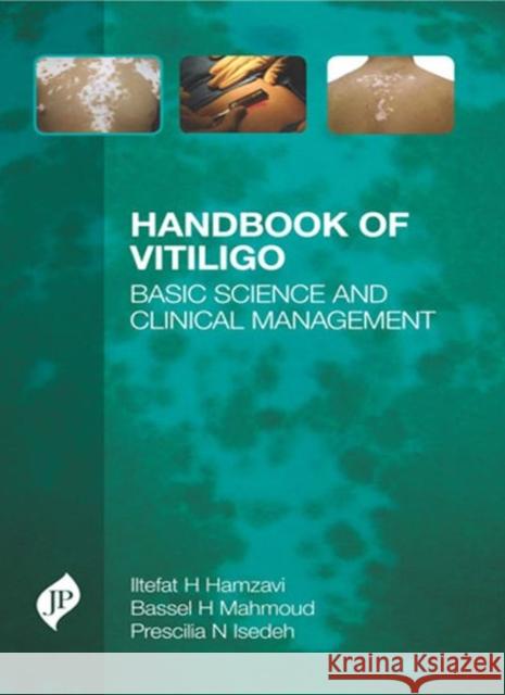 Handbook of Vitiligo: Basic Science and Clinical Management Iltefat Hamzavi Bassel H. Mahmoud Prescilia N. Isedeh 9781907816963 JP Medical Ltd - książka