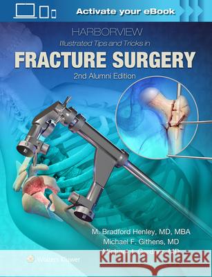 Harborview Illustrated Tips and Tricks in Fracture Surgery M. Henley 9781496355980 Lippincott Williams and Wilkins - książka