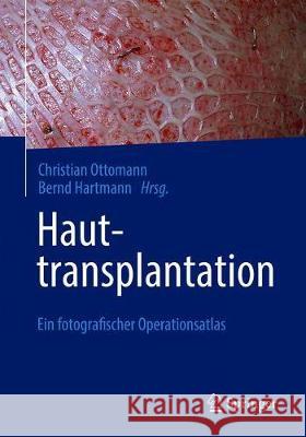 Hauttransplantation: Ein Fotografischer Operationsatlas Christian Ottomann Bernd Hartmann 9783662620595 Springer - książka