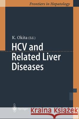 Hcv and Related Liver Diseases Okita, Kiwamu 9784431684909 Springer - książka