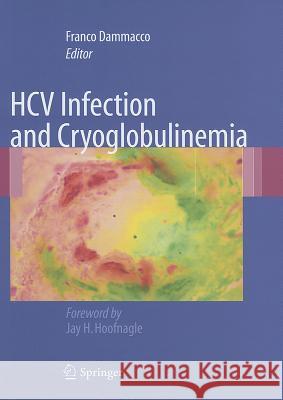 HCV Infection and Cryoglobulinemia Franco Dammacco 9788847017047 Not Avail - książka