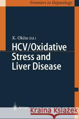 Hcv/Oxidative Stress and Liver Disease M. S. Model' Kiwamu Okita K. Okita 9784431703242 Springer - książka
