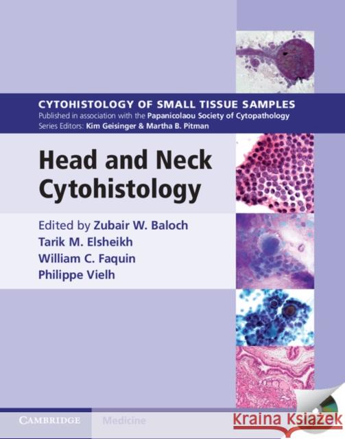 Head and Neck Cytohistology with DVD-ROM Zubair W. Baloch Tarik M. Elsheikh William C. Faquin 9781107669888 Cambridge University Press - książka