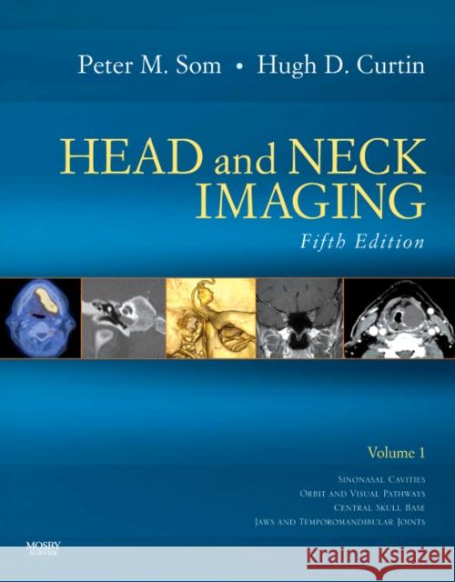 Head and Neck Imaging - 2 Volume Set: Expert Consult- Online and Print Som, Peter M. 9780323053556 Elsevier - Health Sciences Division - książka