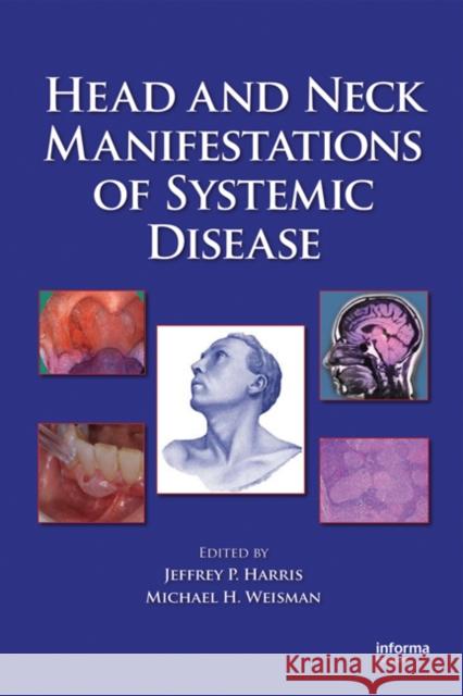 Head and Neck Manifestations of Systemic Disease Jeffrey P. Harris Michael H. Weisman 9780849340505 Informa Healthcare - książka