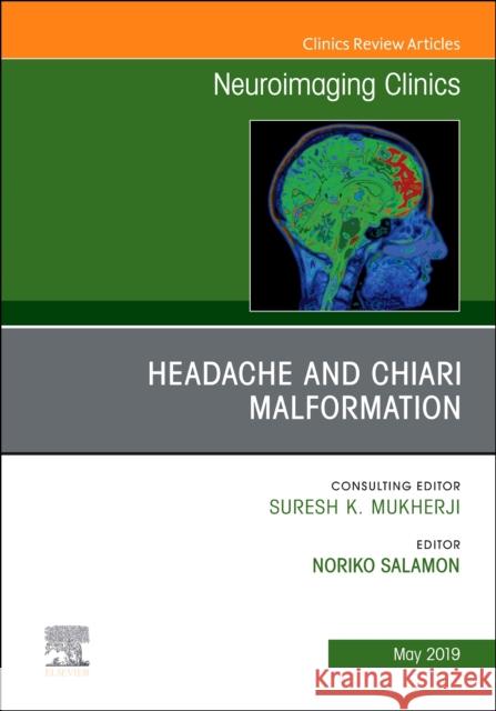 Headache and Chiari Malformation, an Issue of Neuroimaging Clinics of North America: Volume 29-2 Salamon, Noriko 9780323677820 Elsevier - książka