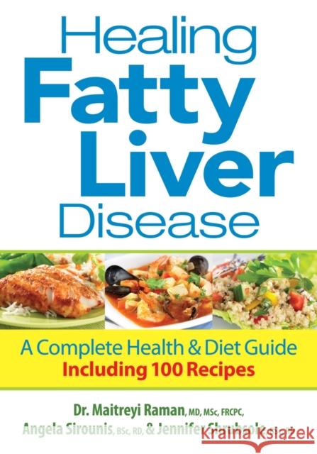 Healing Fatty Liver Disease: A Complete Health and Diet Guide, Including 100 Recipes Dr. Lorian, RD, PhD Taylor 9780778804376  - książka