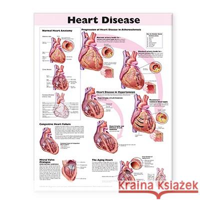Heart Disease Anatomical Chart Chart Company Anatomical Anatomical Chart Company 9780781773386 Lippincott Williams & Wilkins - książka
