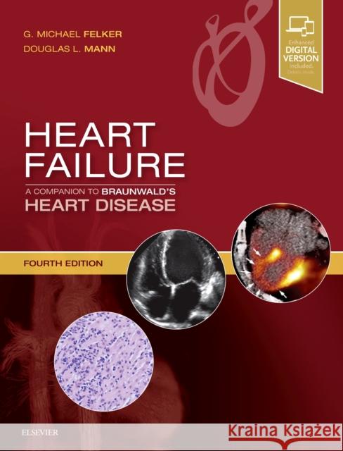 Heart Failure: A Companion to Braunwald's Heart Disease G. Michael Felker Douglas L. Mann 9780323609876 Elsevier - książka
