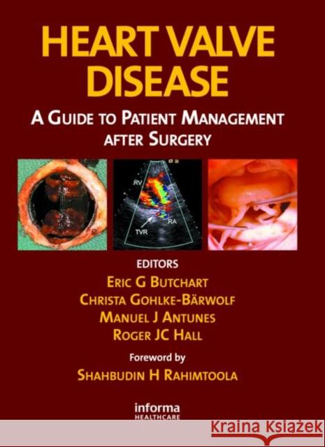 Heart Valve Disease: A Guide to Patient Management After Surgery Butchart, Eric G. 9781842143087 Informa Healthcare - książka
