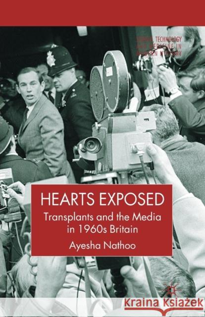Hearts Exposed: Transplants and the Media in 1960s Britain Nathoo, A. 9781349541355 Palgrave MacMillan - książka