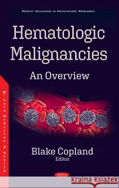Hematologic Malignancies: An Overview Blake Copland   9781536181241 Nova Science Publishers Inc - książka