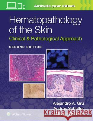 Hematopathology of the Skin: Clinical & Pathological Approach Alejandro Ariel Gru 9781975158552 LWW - książka