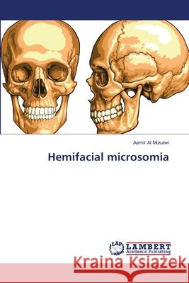 Hemifacial microsomia Aamir A 9786139829149 LAP Lambert Academic Publishing - książka
