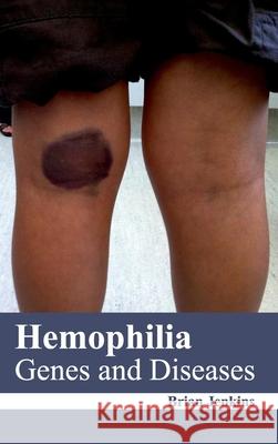 Hemophilia: Genes and Diseases Brian Jenkins 9781632422279 Foster Academics - książka