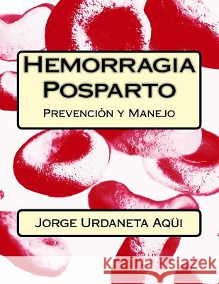 Hemorragia posparto: Prevención y Manejo Aqui, Jorge Urdaneta 9781987743494 Createspace Independent Publishing Platform - książka
