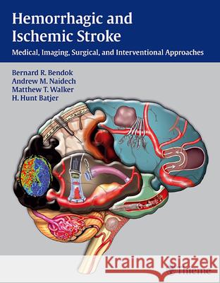 Hemorrhagic and Ischemic Stroke: Medical, Imaging, Surgical and Interventional Approaches [With Web Access] Bendok, Bernard 9781604062342  - książka