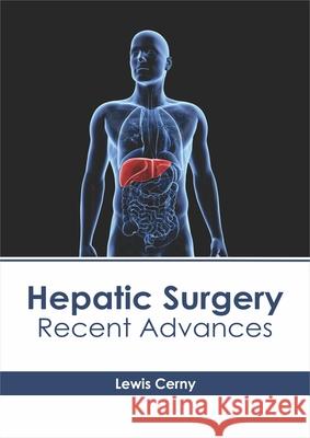 Hepatic Surgery: Recent Advances Lewis Cerny 9781632416346 Hayle Medical - książka