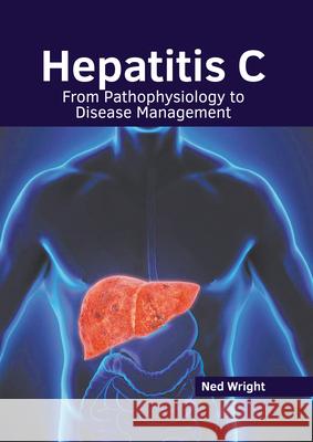 Hepatitis C: From Pathophysiology to Disease Management Ned Wright 9781632418753 Hayle Medical - książka