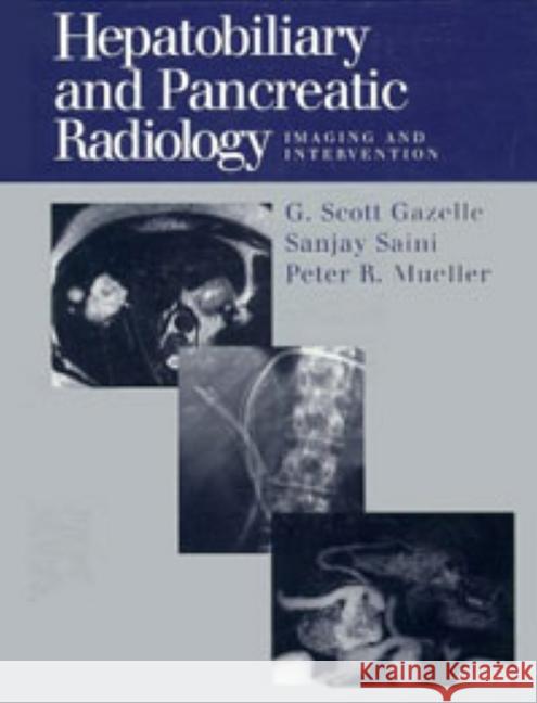 Hepatobiliary and Pancreatic Radiology : Imaging and Intervention G. Scott Gazelle Paul R. Mueller Sanjay Saini 9780865777163 Thieme Medical Publishers - książka