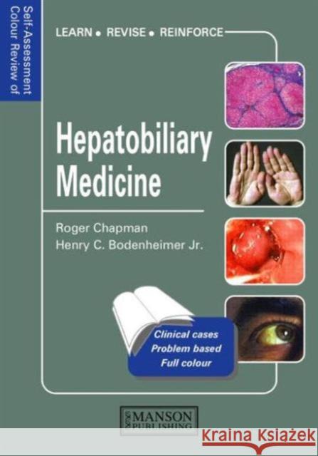 Hepatobiliary Medicine R. Chapman Henry (The Mount Sinai Medical Center New York Bodenheimer 9781874545484 MANSON PUBLISHING LTD - książka