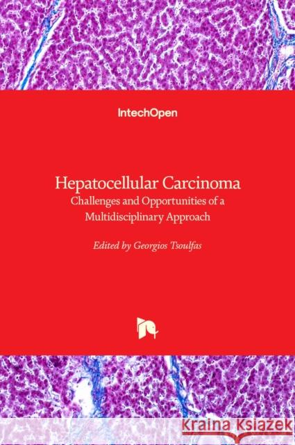 Hepatocellular Carcinoma: Challenges and Opportunities of a Multidisciplinary Approach Georgios Tsoulfas   9781839691102 Intechopen - książka