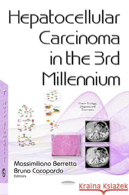 Hepatocellular Carcinoma in the 3rd Millennium Dr Massimiliano Berretta, Bruno Cacopardo 9781634840255 Nova Science Publishers Inc - książka