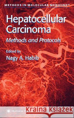 Hepatocellular Carcinoma: Methods and Protocols Habib, Nagy A. 9780896037854 Humana Press - książka