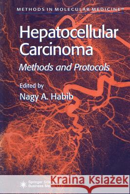 Hepatocellular Carcinoma: Methods and Protocols Habib, Nagy A. 9781489941695 Humana Press - książka