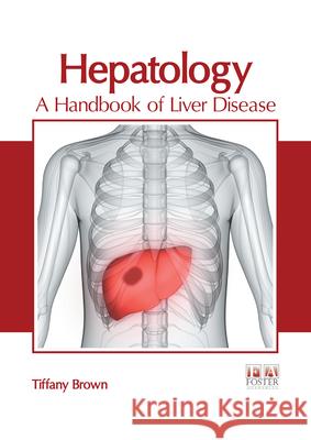 Hepatology: A Handbook of Liver Disease Tiffany Brown 9781632429551 Foster Academics - książka
