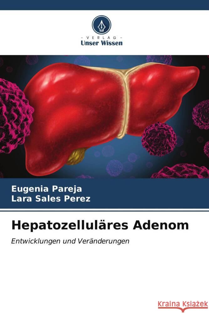 Hepatozelluläres Adenom Pareja, Eugenia, Sales Perez, Lara 9786206627852 Verlag Unser Wissen - książka