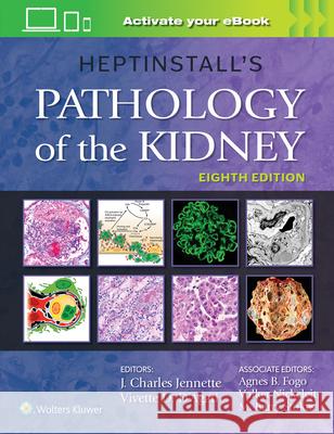 Heptinstall's Pathology of the Kidney J. Charles Jennette Vivette D. D'Agati 9781975161538 Wolters Kluwer Health - książka