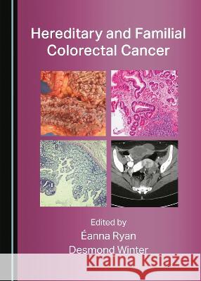 Hereditary and Familial Colorectal Cancer Desmond Winter Eanna Ryan  9781527587342 Cambridge Scholars Publishing - książka