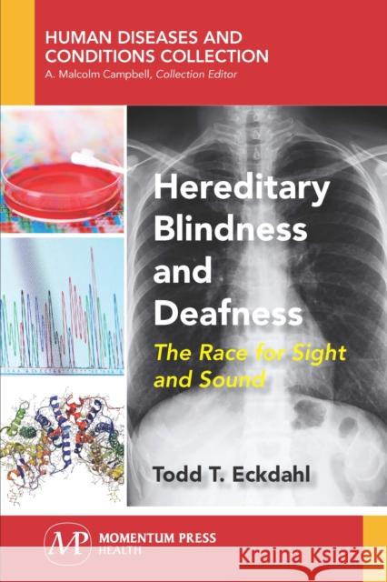 Hereditary Blindness and Deafness: The Race for Sight and Sound Todd T. Eckdahl 9781944749736 Momentum Press - książka