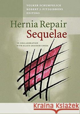 Hernia Repair Sequelae Schumpelick                              Volker Schumpelick Joachim Conze 9783642045523 Springer - książka