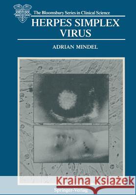 Herpes Simplex Virus Adrian Mindel 9781447116851 Springer - książka