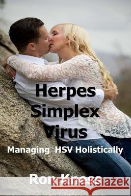 Herpes Simplex Virus: Managing Hsv Holistically Ron Kness 9781717384645 Createspace Independent Publishing Platform - książka