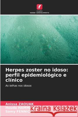 Herpes zoster no idoso: perfil epidemiológico e clínico Zaouak, Anissa, Hammami, Houda, Fenniche, Samy 9786207838653 Edições Nosso Conhecimento - książka