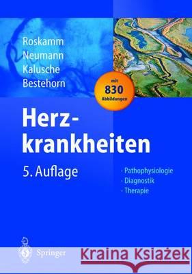 Herzkrankheiten: Pathophysiologie Diagnostik Therapie Roskamm, Helmut 9783642622205 Springer - książka