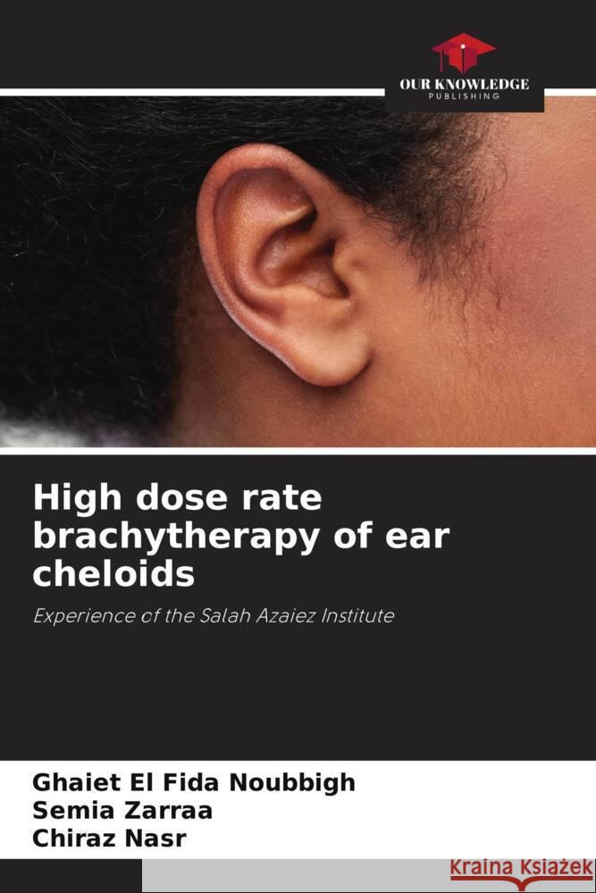 High dose rate brachytherapy of ear cheloids Noubbigh, Ghaiet El Fida, Zarraa, Semia, Nasr, Chiraz 9786205472392 Our Knowledge Publishing - książka