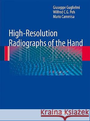 High-Resolution Radiographs of the Hand Giuseppe Guglielmi Wilfred C. G. Peh 9783540794790 Springer - książka