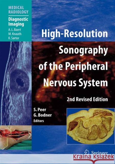 High-Resolution Sonography of the Peripheral Nervous System A.L. Baert, G. Bodner, H. Gruber, S. Kiechl, P. Kovacs, S. Peer, H. Piza-Katzer, Siegfried Peer, Gerd Bodner 9783540490838 Springer-Verlag Berlin and Heidelberg GmbH &  - książka