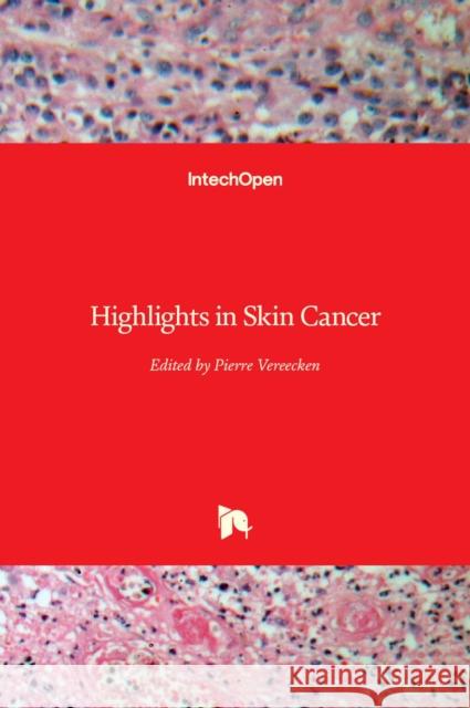 Highlights in Skin Cancer Pierre Vereecken 9789535110736 Intechopen - książka