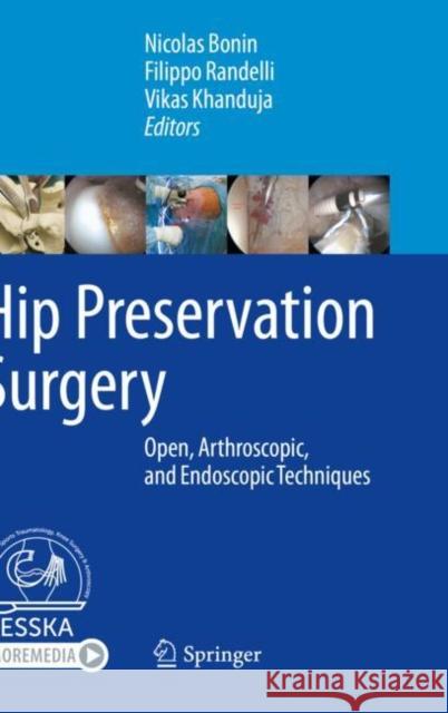 Hip Preservation Surgery: Open, Arthroscopic, and Endoscopic Techniques Nicolas Bonin Filippo Randelli Vikas Khanduja 9783662611883 Springer - książka