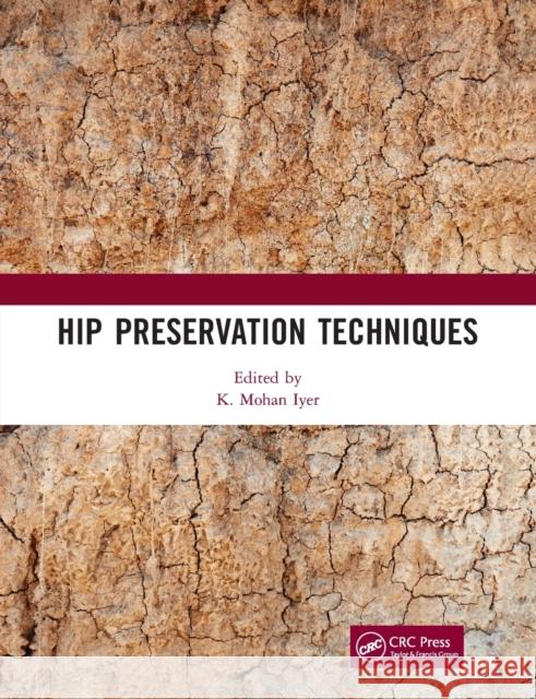 Hip Preservation Techniques K. Mohan Iyer 9780367729899 CRC Press - książka