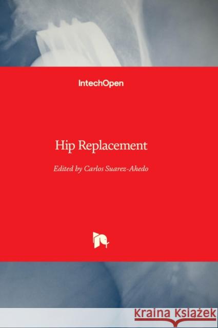 Hip Replacement Carlos Suarez-Ahedo 9781803557595 IntechOpen - książka