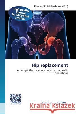Hip replacement Edward R Miller-Jones 9786130142728 Fastbook Publishing - książka