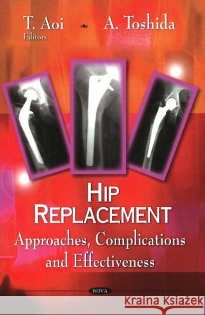 Hip Replacement: Approaches, Complications & Effectiveness T Aoi, A Toshida 9781606923269 Nova Science Publishers Inc - książka