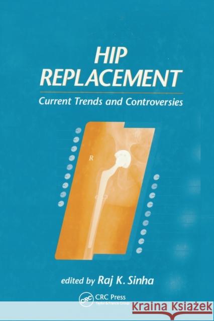 Hip Replacement: Current Trends and Controversies Raj K. Sinha 9780367446994 CRC Press - książka