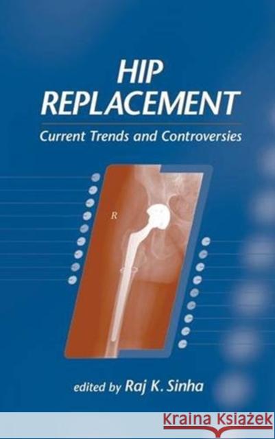 Hip Replacement: Current Trends and Controversies Sinha, Raj K. 9780824707897 Marcel Dekker - książka